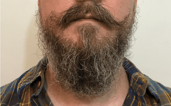 Honest Amish Beard Balm Before and After Photos