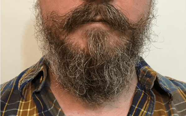 Beard After Honest Amish Beard Balm
