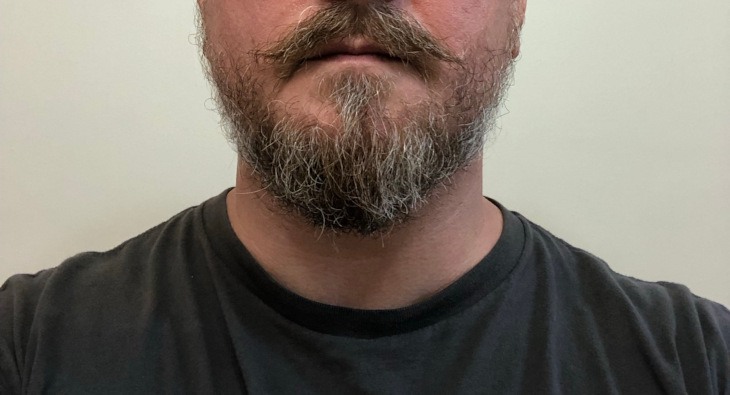 Short Beard After Beard Balm