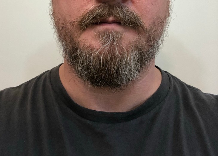 Short Beard Before Beard Balm