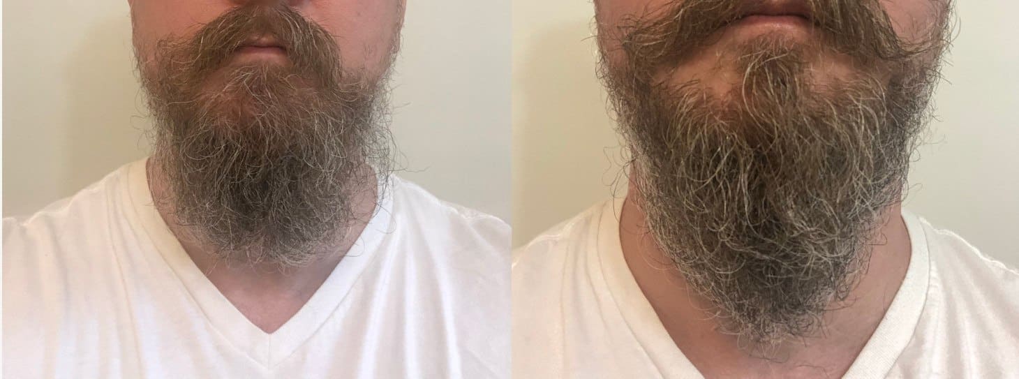 beard balm before and after