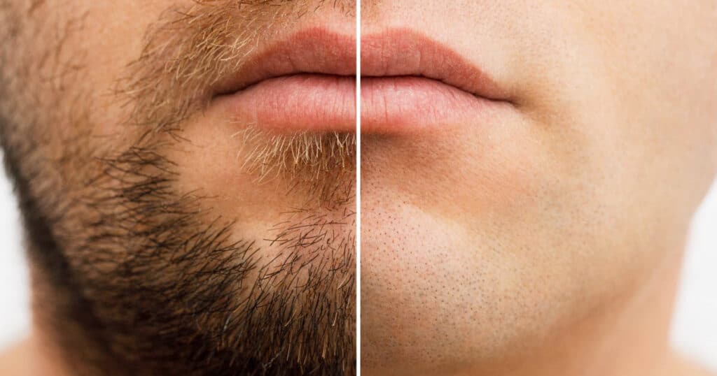 Should I Shave My Beard