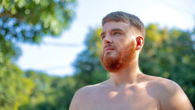 Beard Protects from Sun Damage