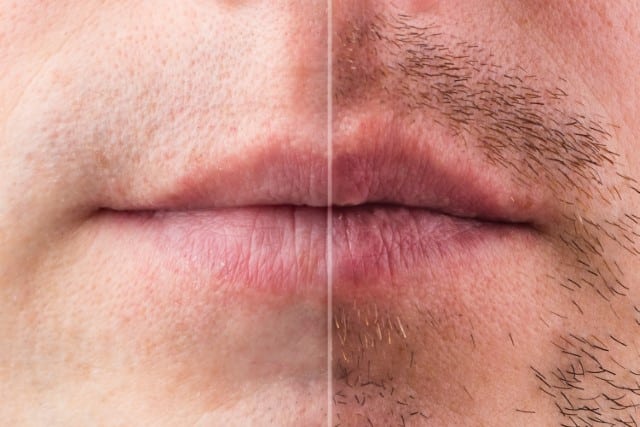 Shaving Doesn't Make Hair Grow More